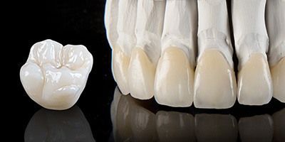 Керамические виниры e max в клинике ЦЭЛТ в Москве