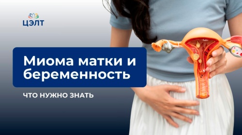 Миома матки и беременность: что нужно знать