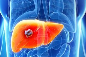 Кисты печени, почек, забрюшинного пространства