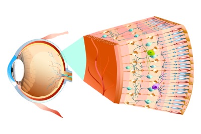 Реваскуляризация хориоидеи в клинике ЦЭЛТ в Москве