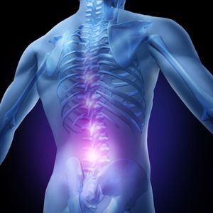 Спондилоартроз пояснично крестцового отдела позвоночника