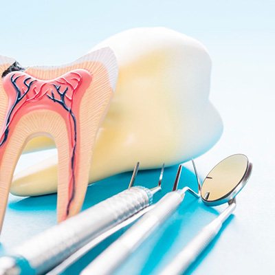 Гемисекция зуба в клинике ЦЭЛТ в Москве