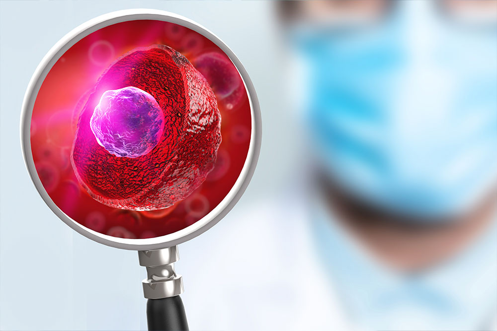 Биопсия молочной железы, клиника ЦЭЛТ