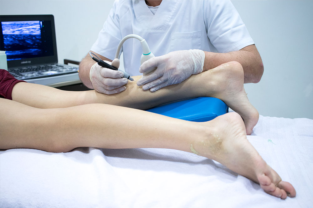 Проведение радиочастотной абляции варикозных вен в клинике ЦЭЛТ