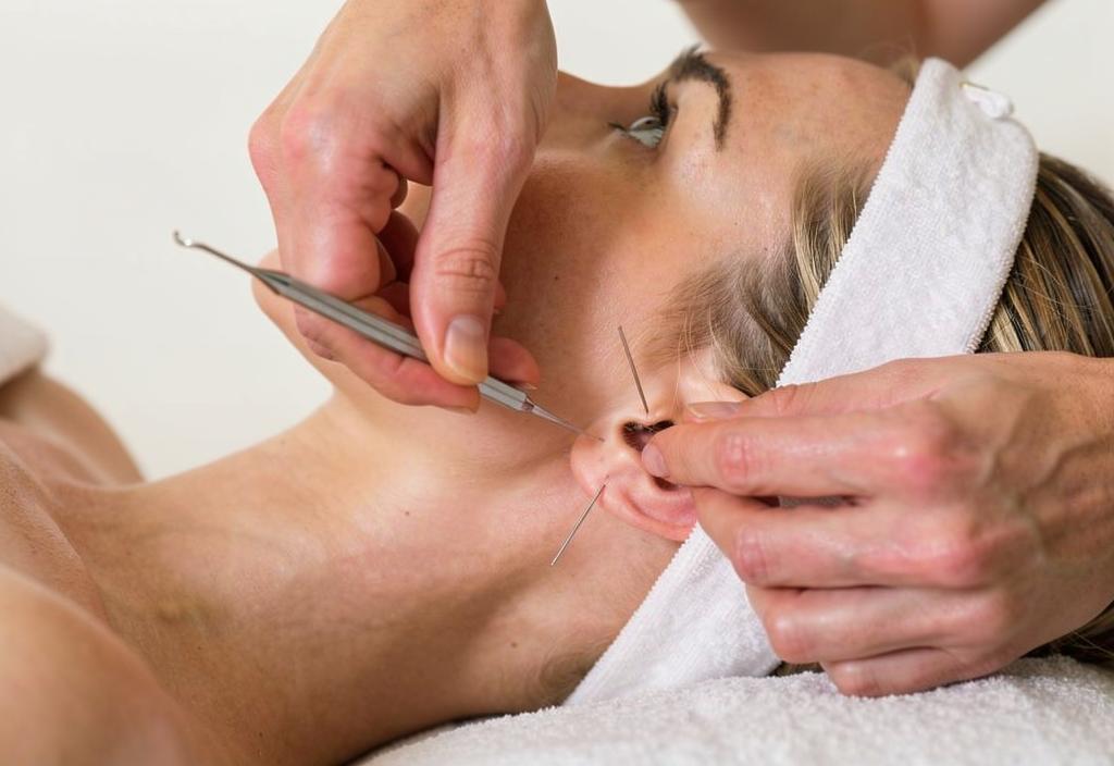 аурикулярная акупунктура в клинике цэлт