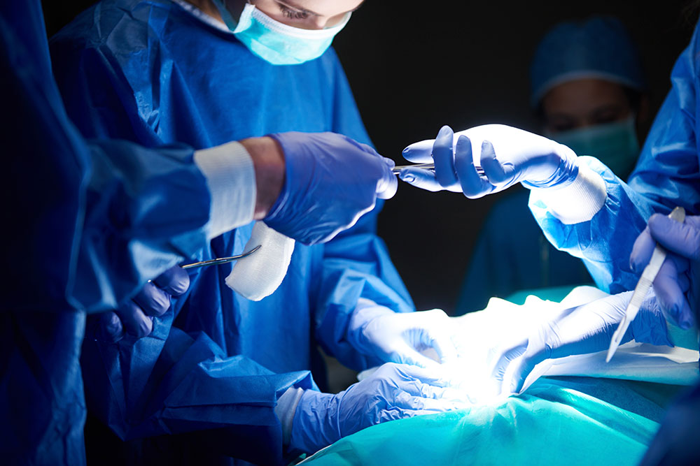 Операция продольной резекции желудка