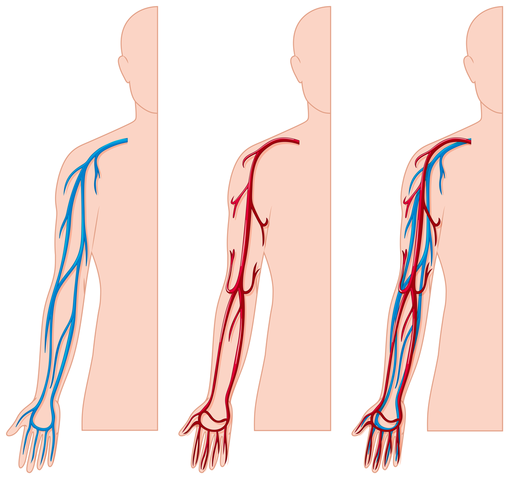УЗДГ вен верхних конечностей, запись на диагностику в клинику ЦЭЛТ