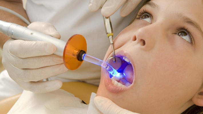 Наложение временной пломбы (светоотверждаемая) в клинике ЦЭЛТ в Москве