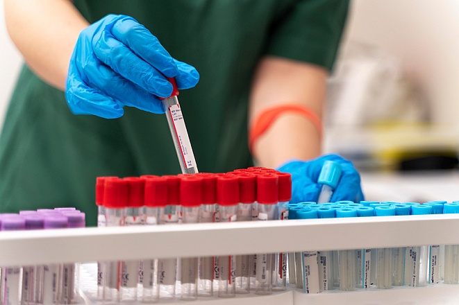 Анализ крови на инфаркт тропонин